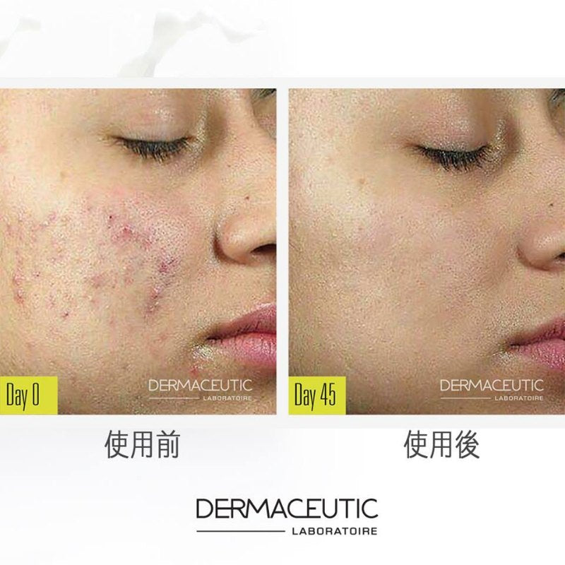 DERMACEUTIC-MilkPeel-Treatment-Kit-5SKINLAB-5SKINLAB-COM-32793712230553.jpg